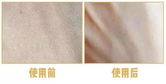 不涂身体乳身体会有多大差别？AG真人国际坚持涂 vs(图3)